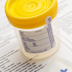 empty urine container
