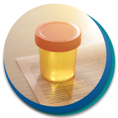 Urine panel test